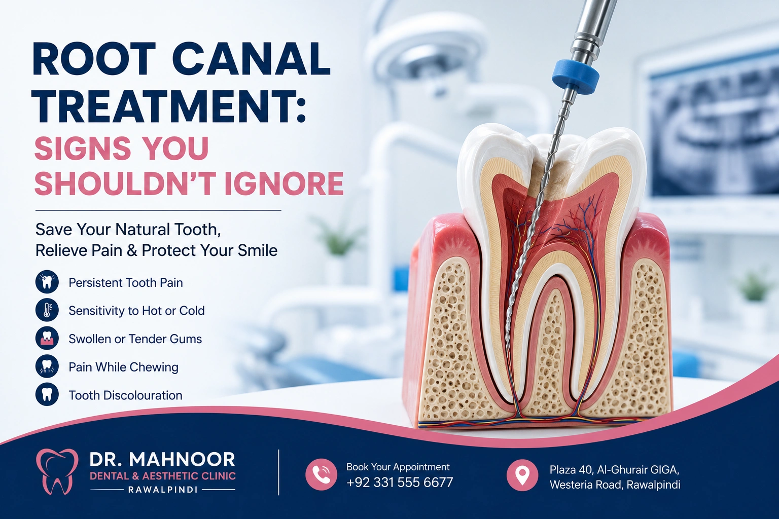 Root Canal Treatment in Rawalpindi