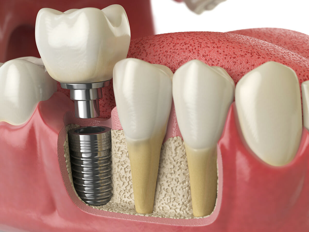 Dental services in Islamabad - Dr. Mahnoor Dental & Aesthetic Clinic